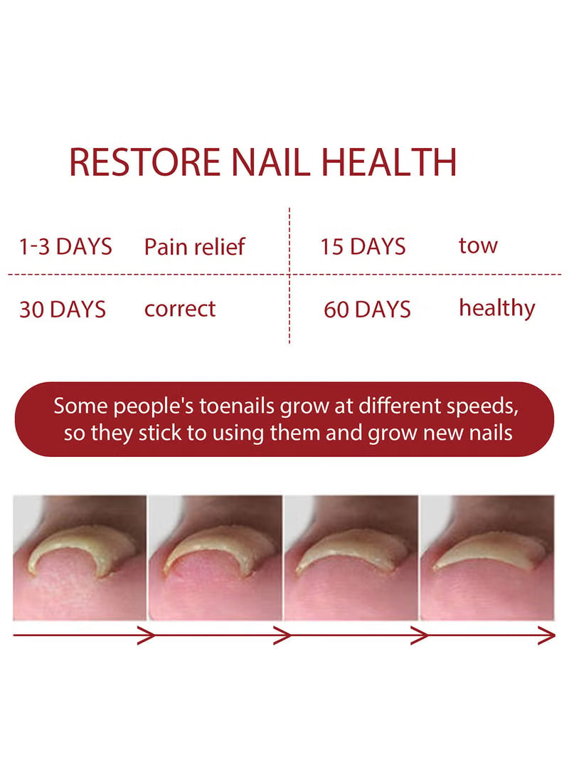 Anti Paronychia Relief Oil