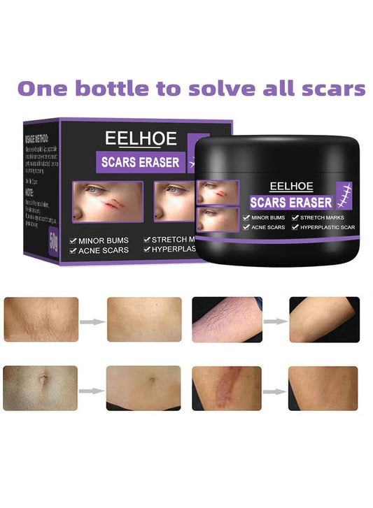Scar Removal Cream