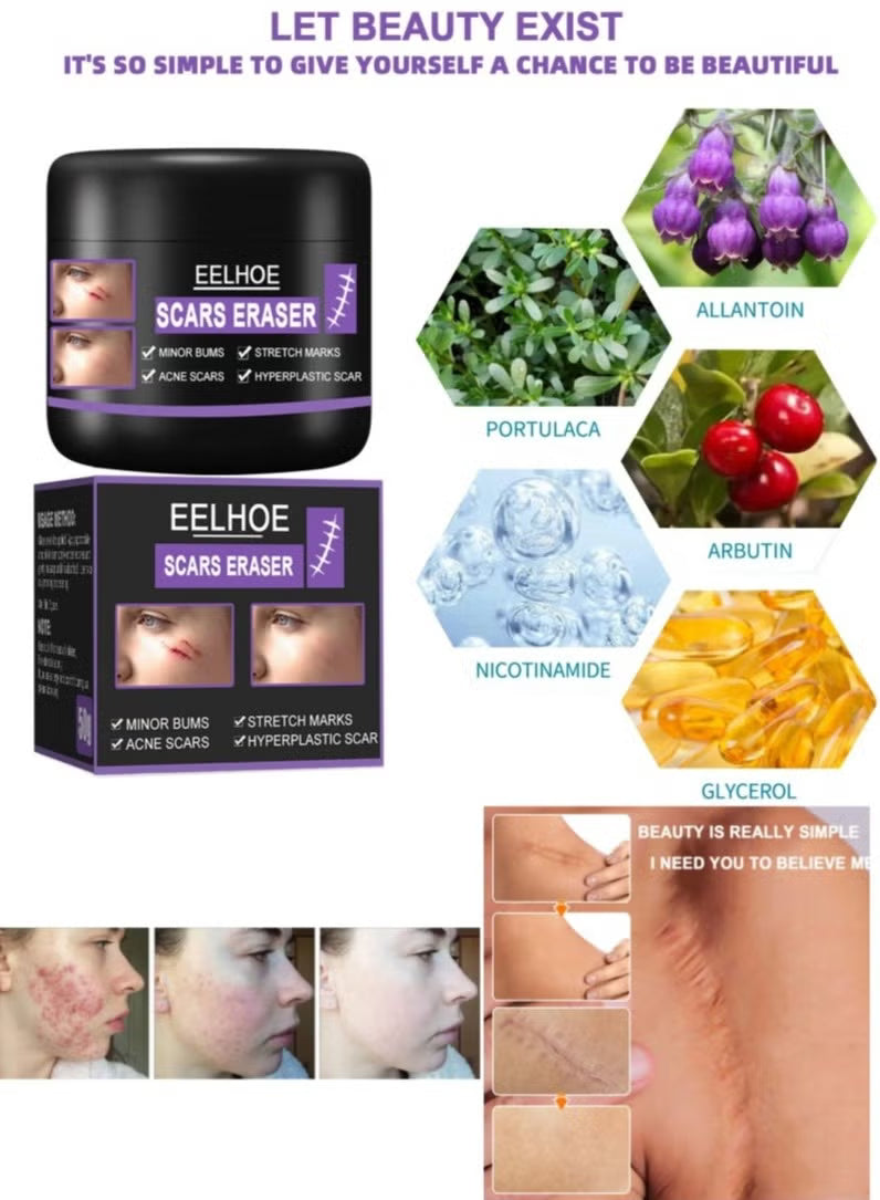 Scar Removal Cream