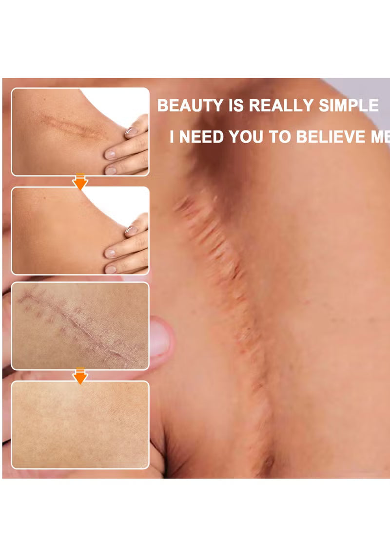Scar Removal Cream