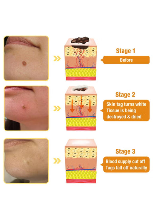 Bee Venom Repair Cream – Professional Treatment for Face & Body