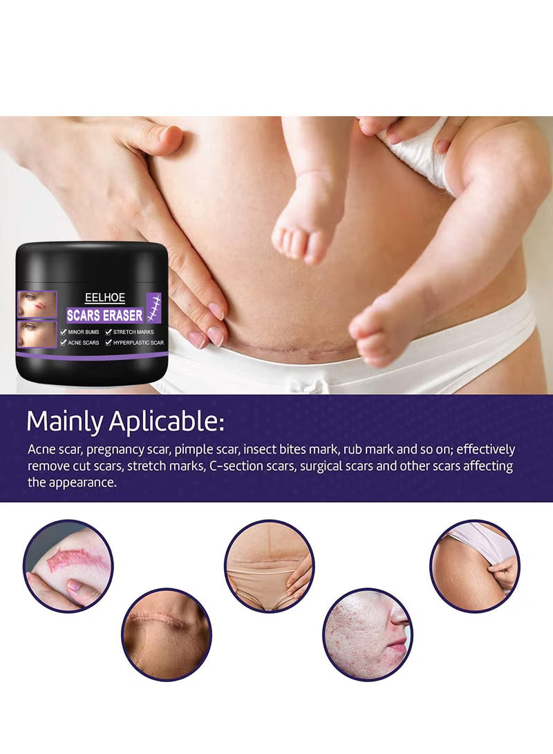 Scar Removal Cream