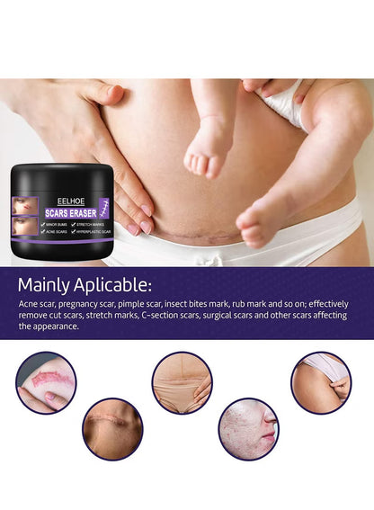 Scar Removal Cream
