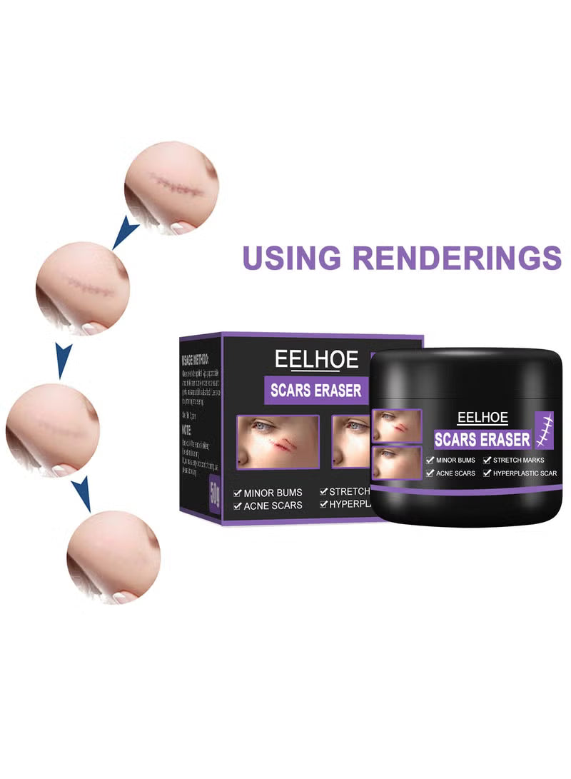 Scar Removal Cream