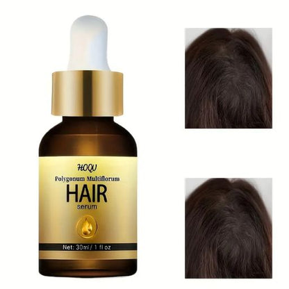 Moisturizing Hair Care Essential Oil - Strengthens and Activates